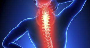 neck and back pain