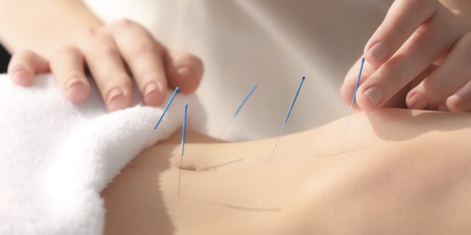 Acupuncture Treatments