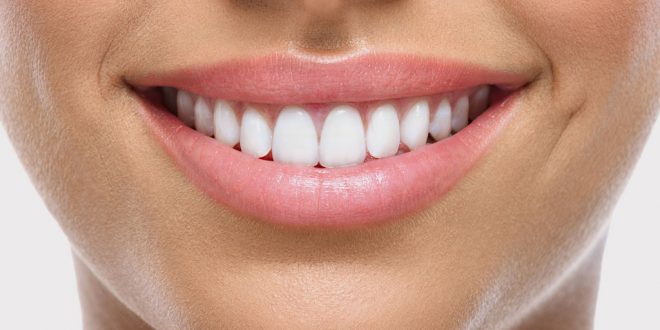 Full Mouth Reconstruction
