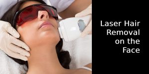 Laser Hair Removal on the Face