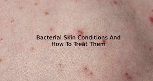 Bacterial Skin Conditions And How To Treat Them