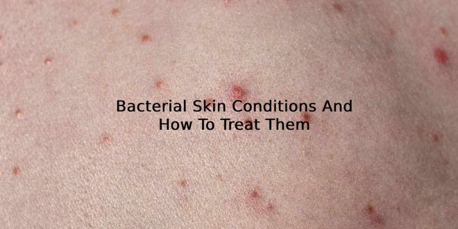 Bacterial Skin Conditions And How To Treat Them