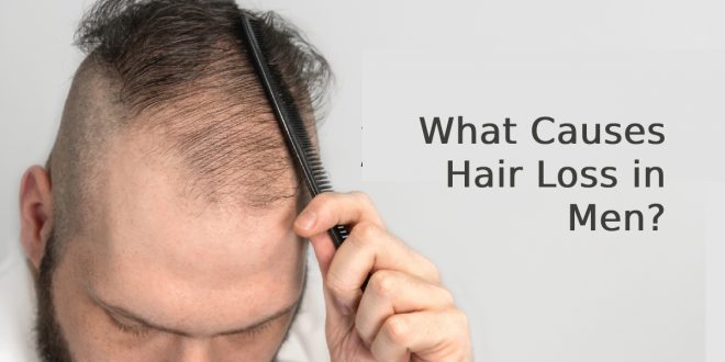 Hair Loss in Men