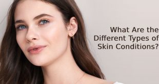 Types of Skin Conditions
