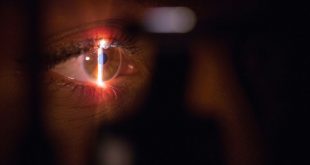 Maintaining Your Vision