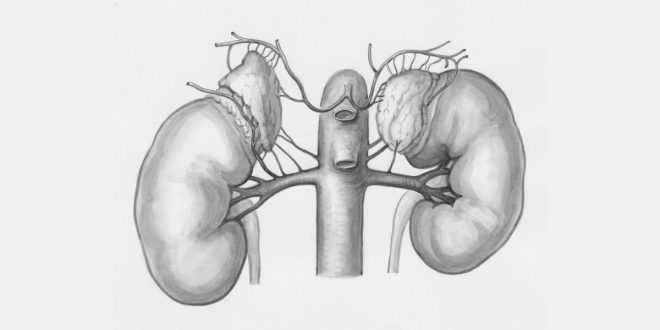 Kidney Transplant