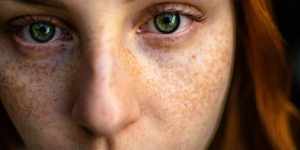 Wellhealthorganic.Com : Remove Dark Spots On Face Tang - Lemon Juice