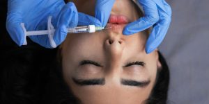 Microneedling