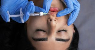 Microneedling