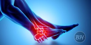 WellHealthOrganic Surgery for Wrist and Ankle Injuries