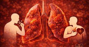 Lung Cancer Symptoms