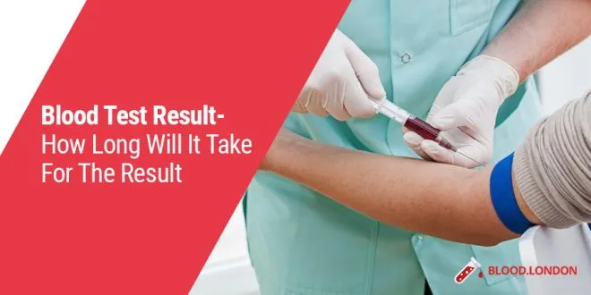 Blood Test Result How Long Will It Take For The Result