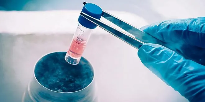 Stem Cell Preservation