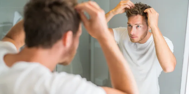 hair loss