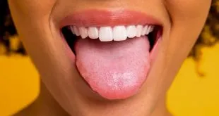 Tongue