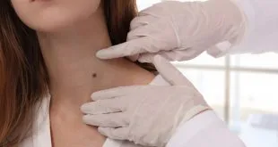 Best Mole Check Clinic