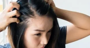 Get Rid of Your Hair Loss Anxiety