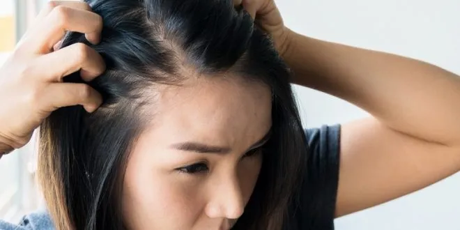 Get Rid of Your Hair Loss Anxiety