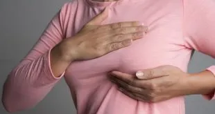 Breast Cancer