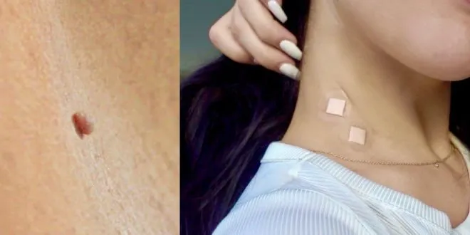End Tag Treatment