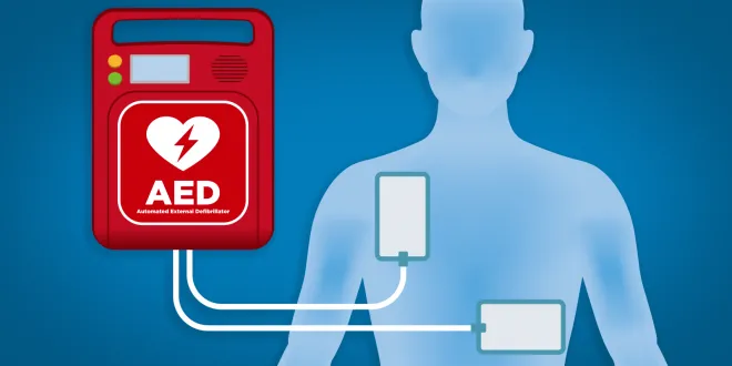 AED equipment
