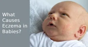 What Causes Eczema in Babies?