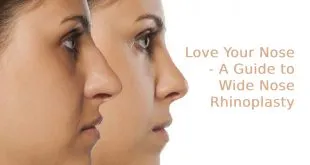 Nose Rhinoplasty