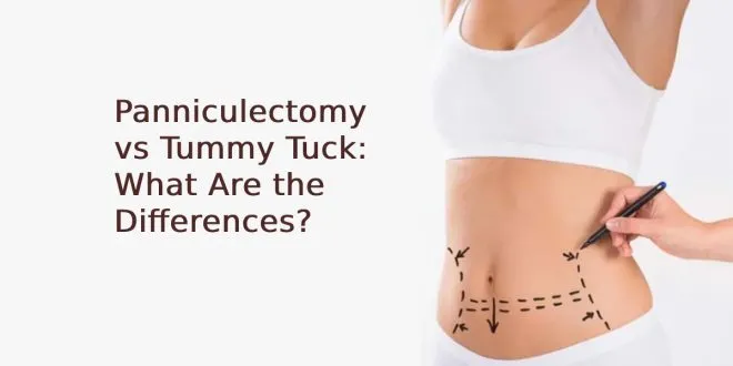 Panniculectomy vs Tummy Tuck