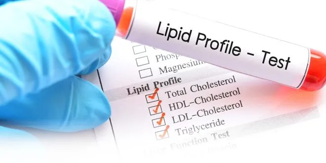 Lipid Profile Test