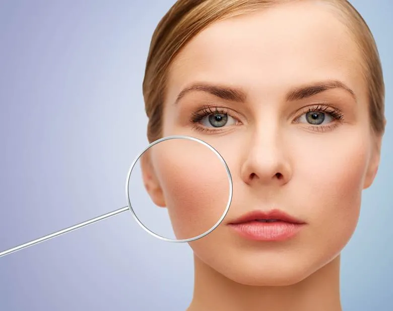 Hyperpigmentation