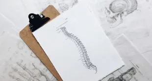 3 Questions to Ask Your Potential Spine Surgeon