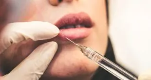Choosing a Botox Provider