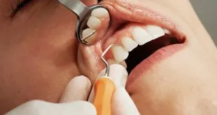 How Long Is a Dentist Appointment