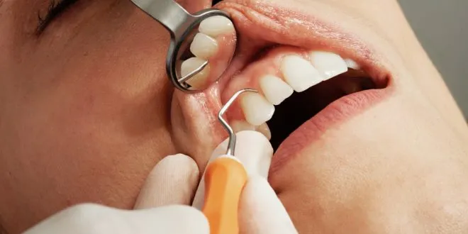 How Long Is a Dentist Appointment