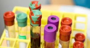 Impact of Blood Type