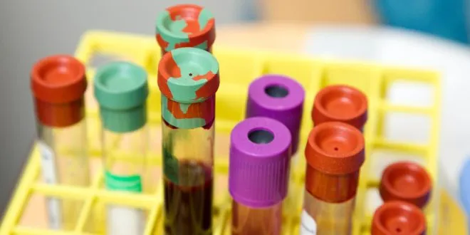 Impact of Blood Type