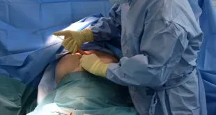 Breast Augmentation Surgery