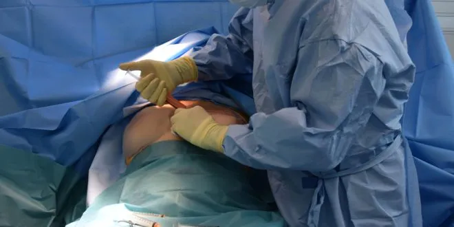 Breast Augmentation Surgery