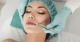 Microneedling