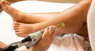 best laser hair removal services