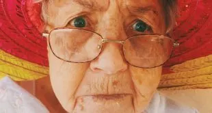 Methods to Avoid a Deep Wrinkle on Your Face