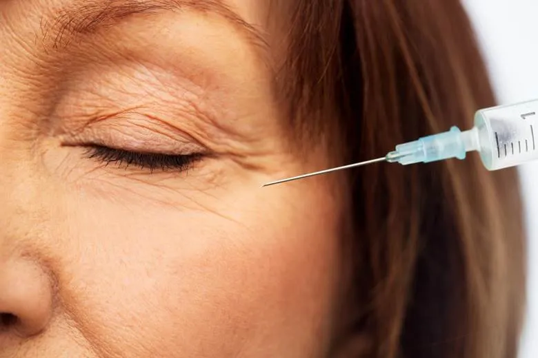 Botox for Undereye Wrinkles