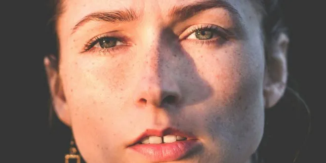 Removing Dark Spots on Face Naturally