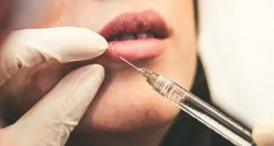 Lip Filler