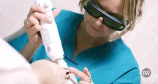 Laser Hair Removal