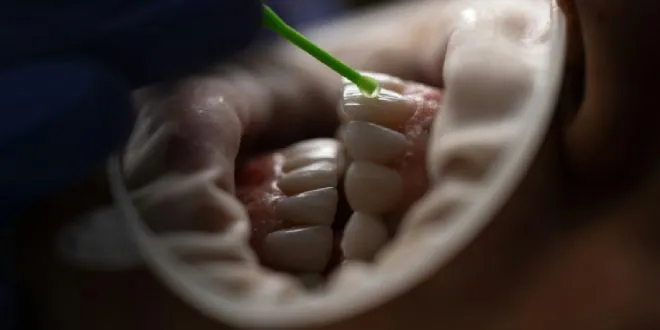 dental emergency