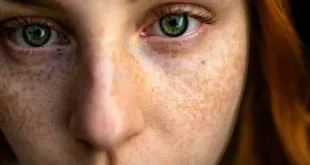Wellhealthorganic.Com : Remove Dark Spots On Face Tang - Lemon Juice