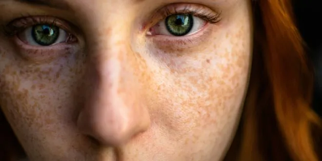 Wellhealthorganic.Com : Remove Dark Spots On Face Tang - Lemon Juice