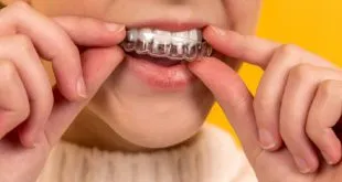Braces