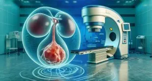 Cancer Treatment